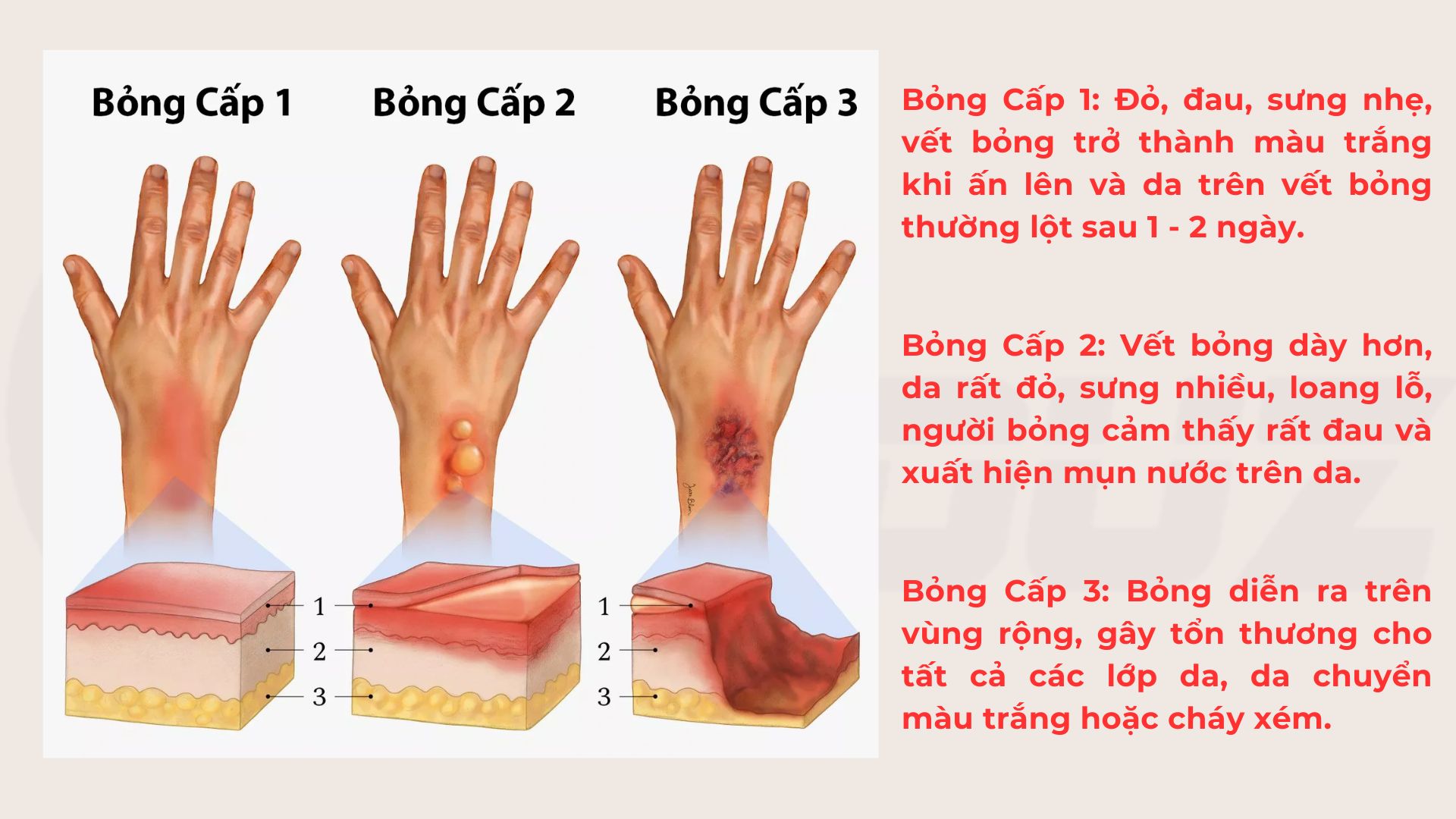 XuTriCaVetBongPhong2