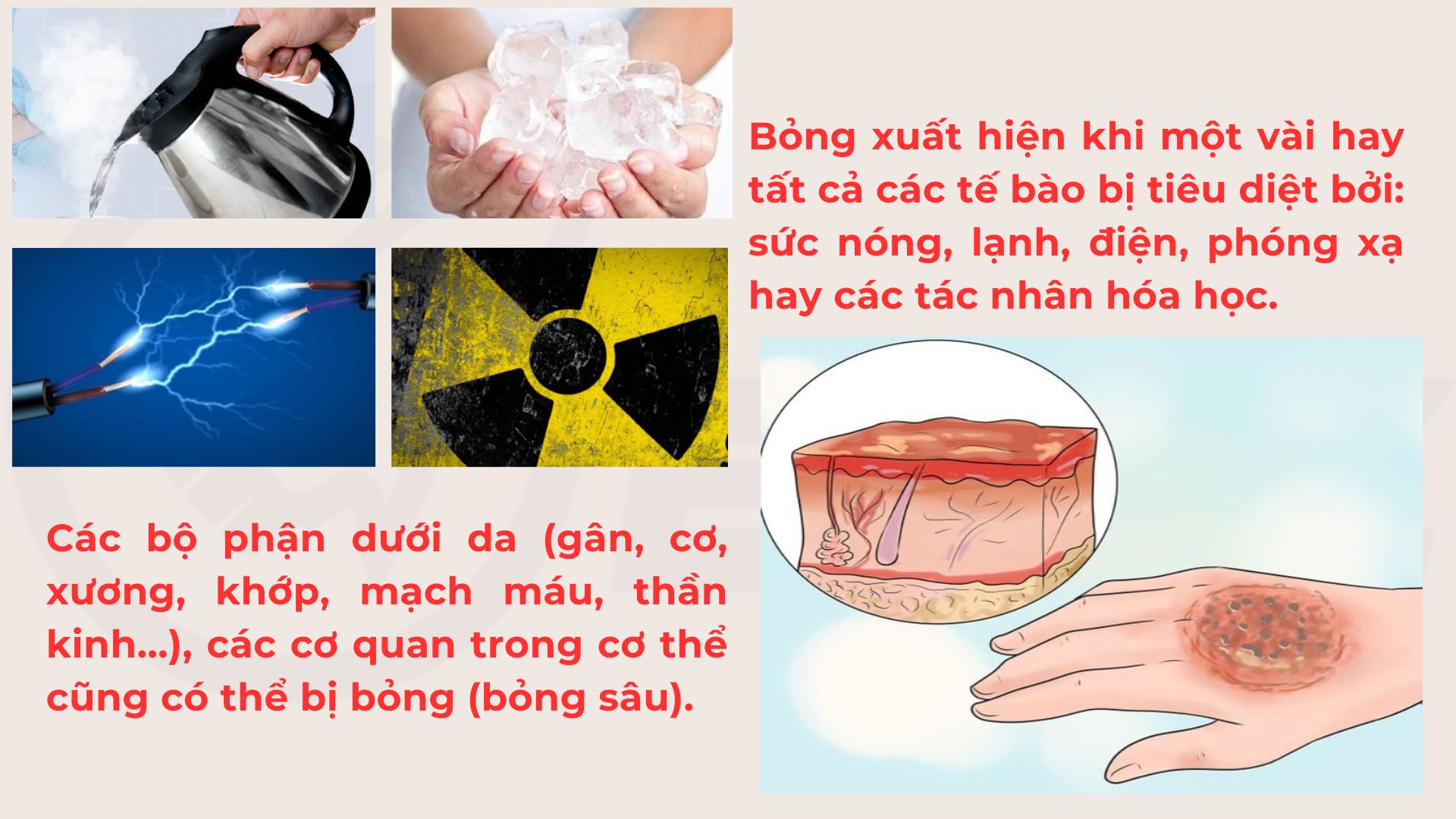 XuTriCaVetBongPhong1