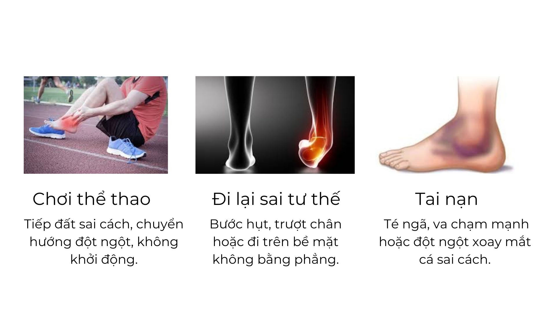 Nguyên nhân gây ra chấn thương mắt cá